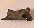Sigmoid Prominent